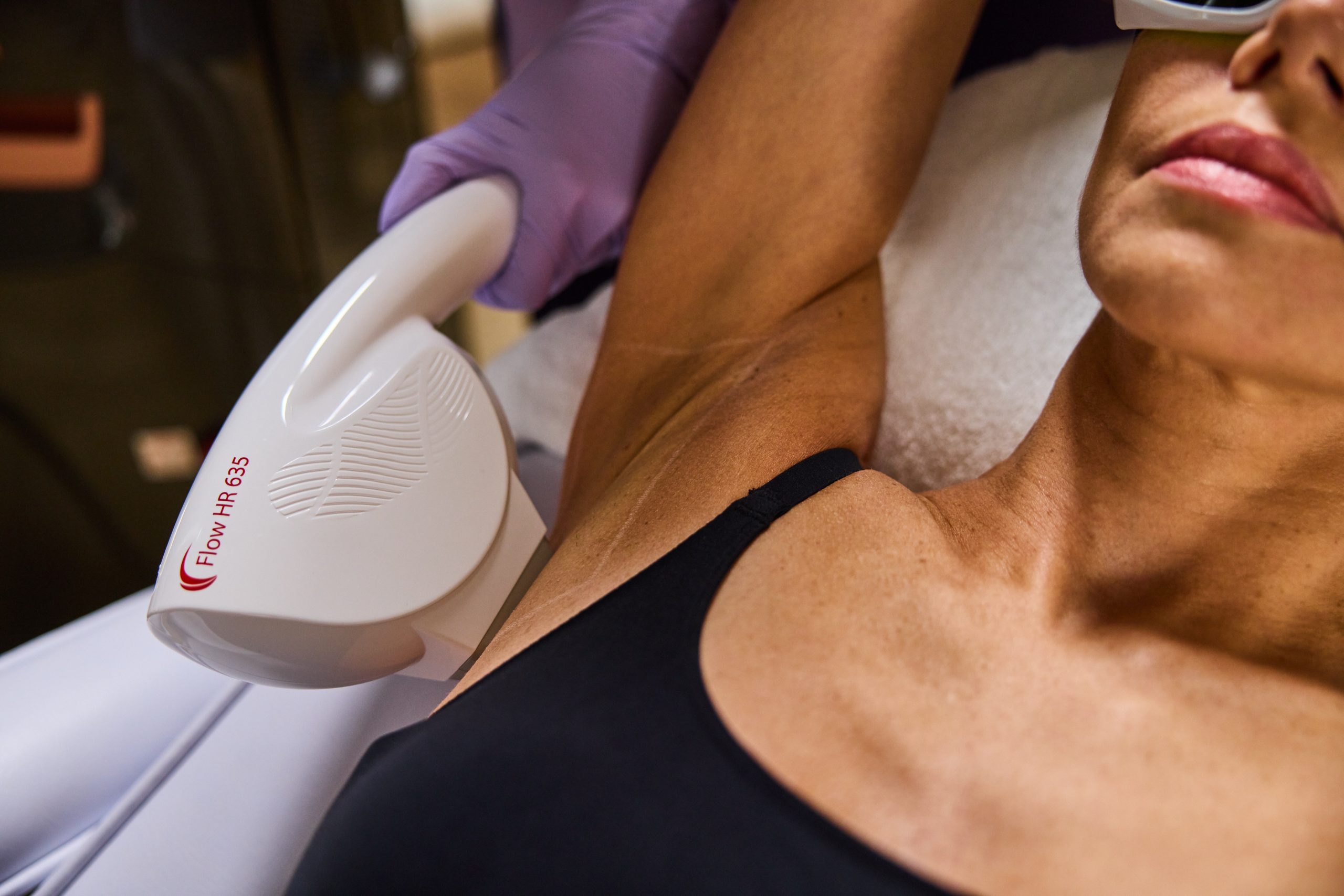 Laser hair removal treatment — Elite Laser Services Saskatoon