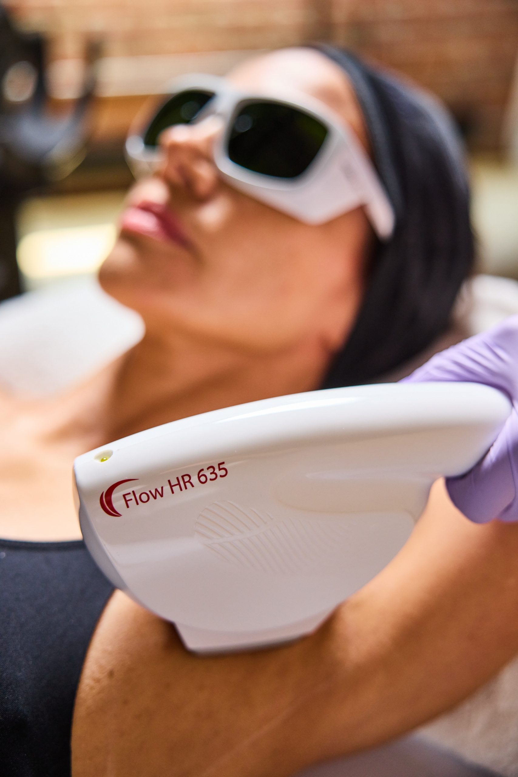 SharpLight laser treatment — Elite Laser Services