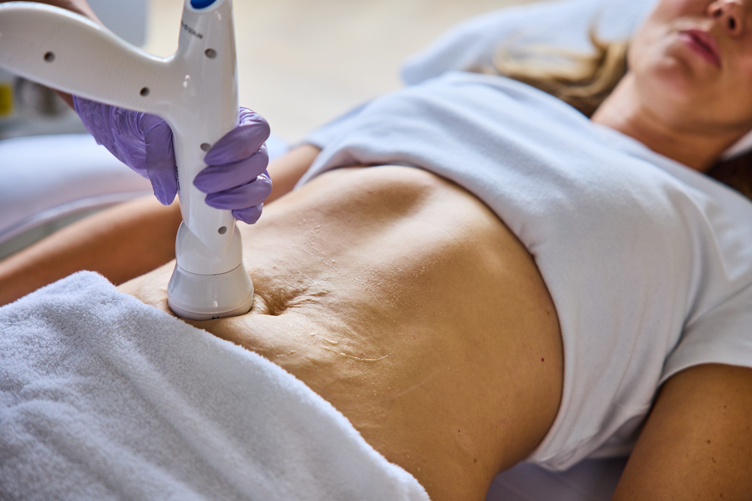 Body contouring treatment — Elite Laser Services Saskatoon