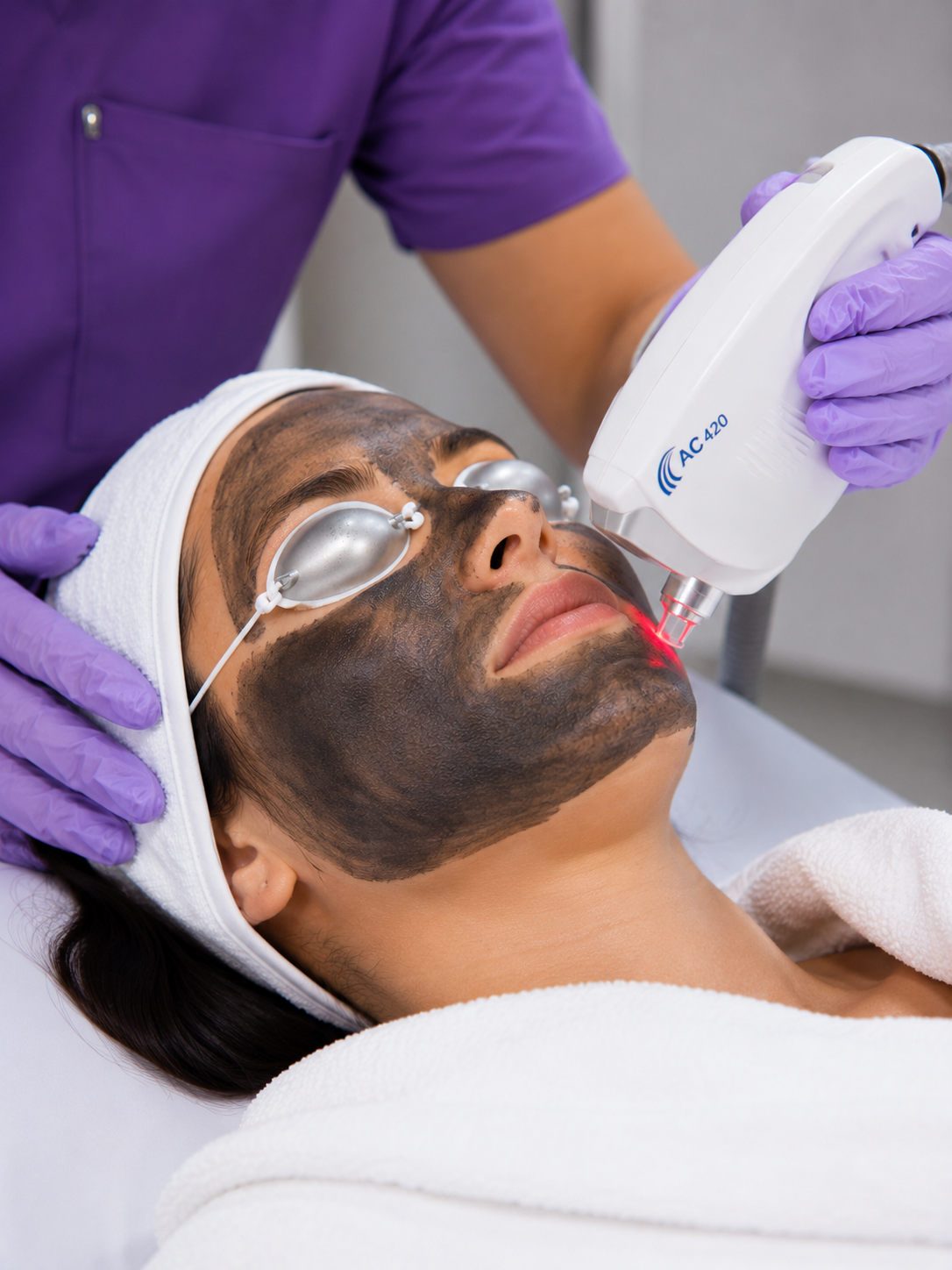 Carbon laser peel — Elite Laser Services Saskatoon