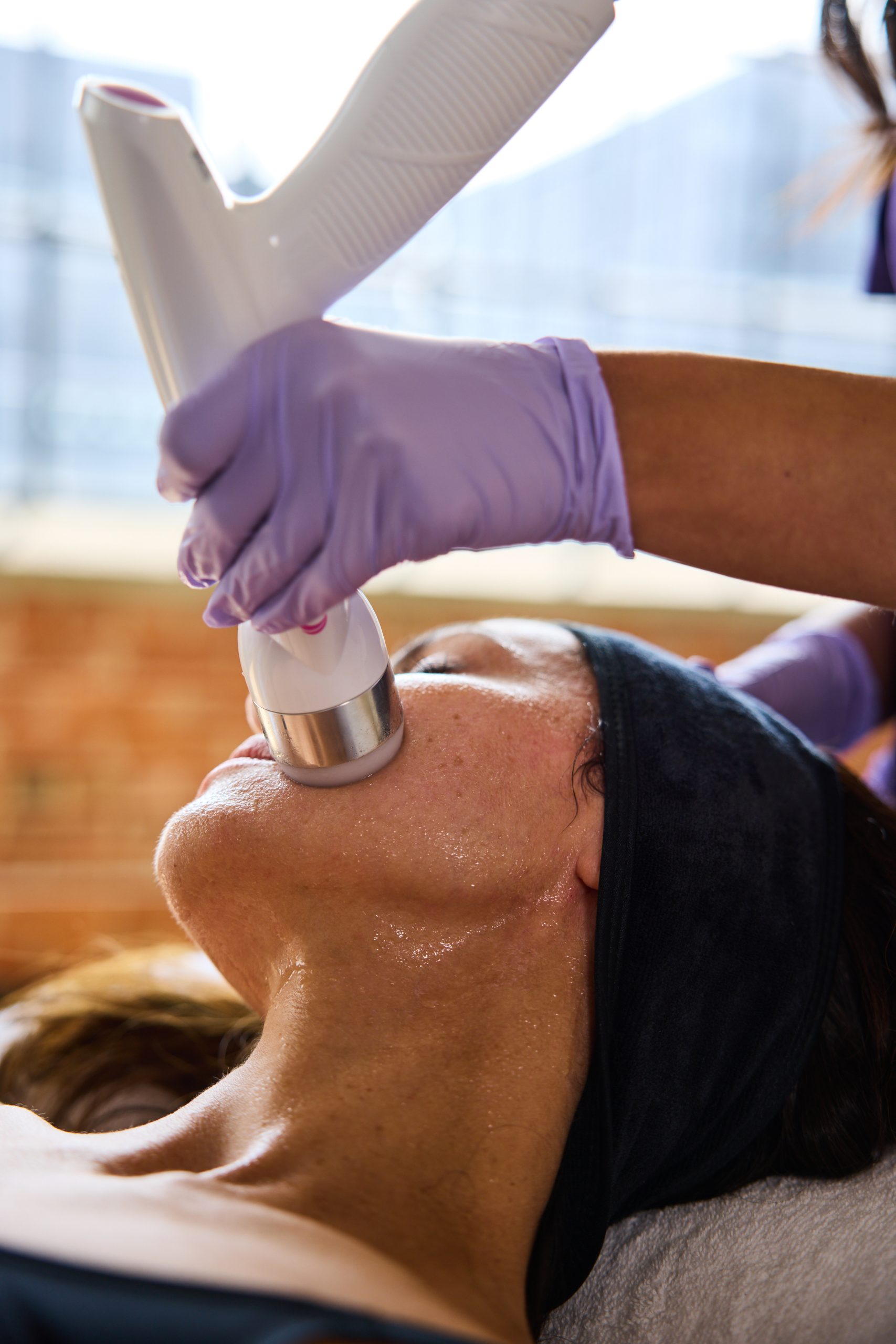 RF facial contouring — Elite Laser Services