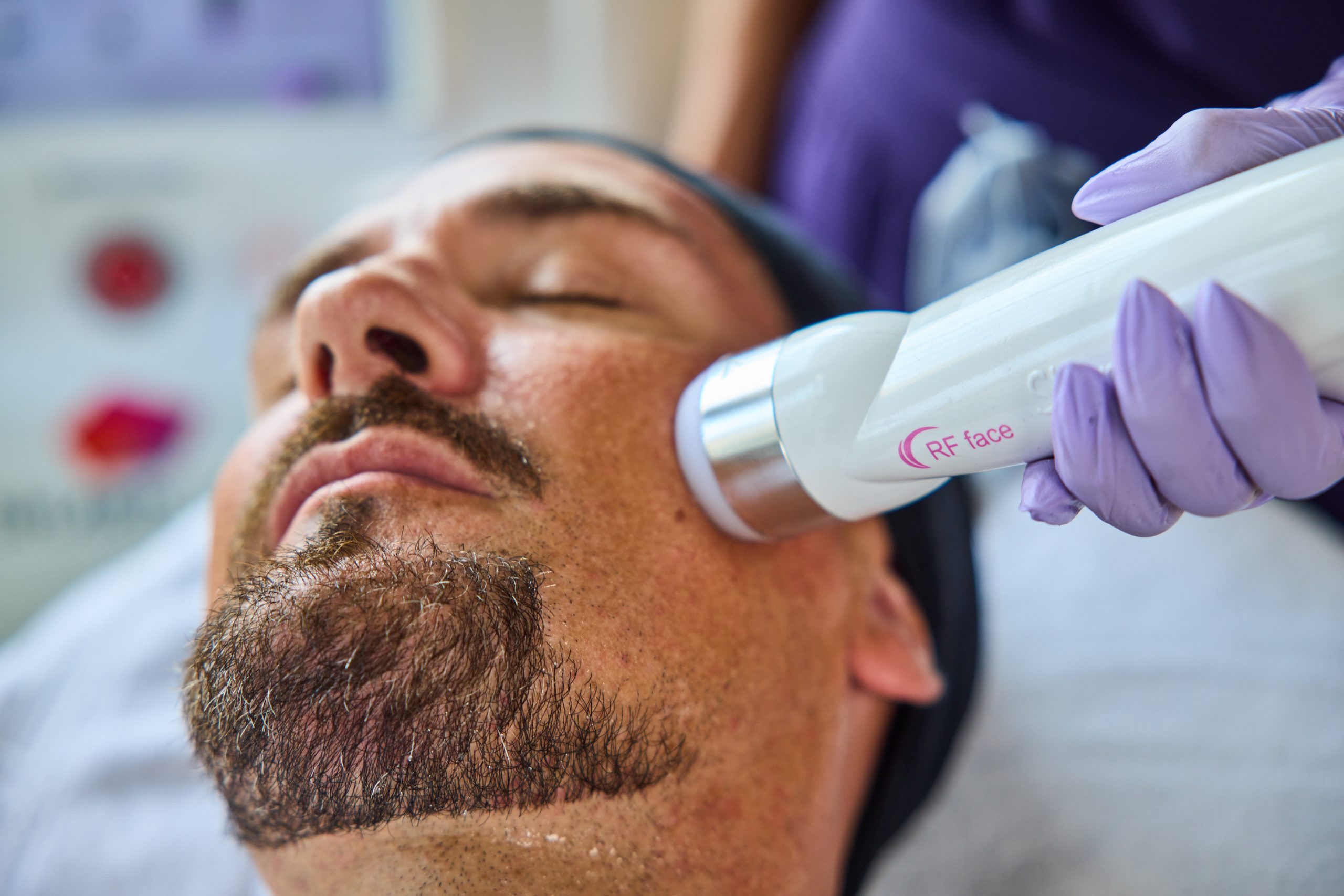 RF face lift — Elite Laser Services Saskatoon