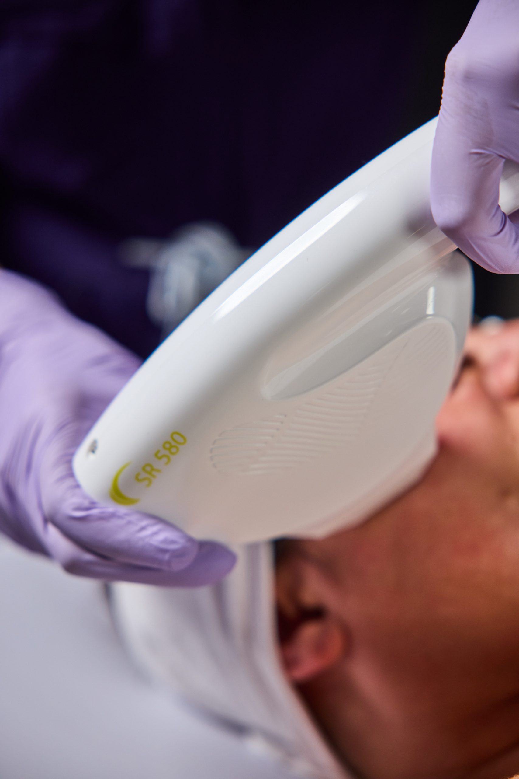 Skin rejuvenation treatment — Elite Laser Services Saskatoon