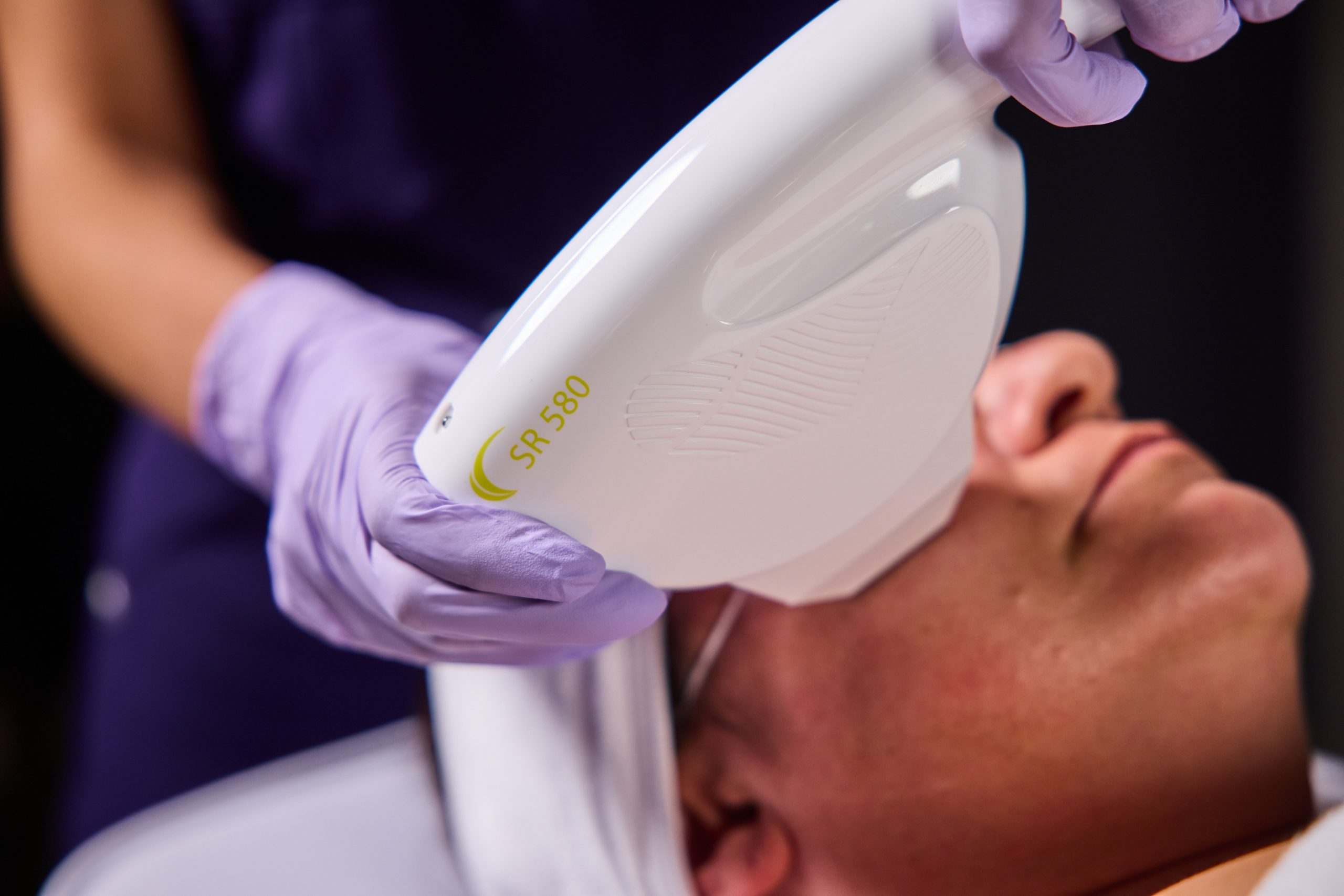 IPL skin rejuvenation — Elite Laser Services
