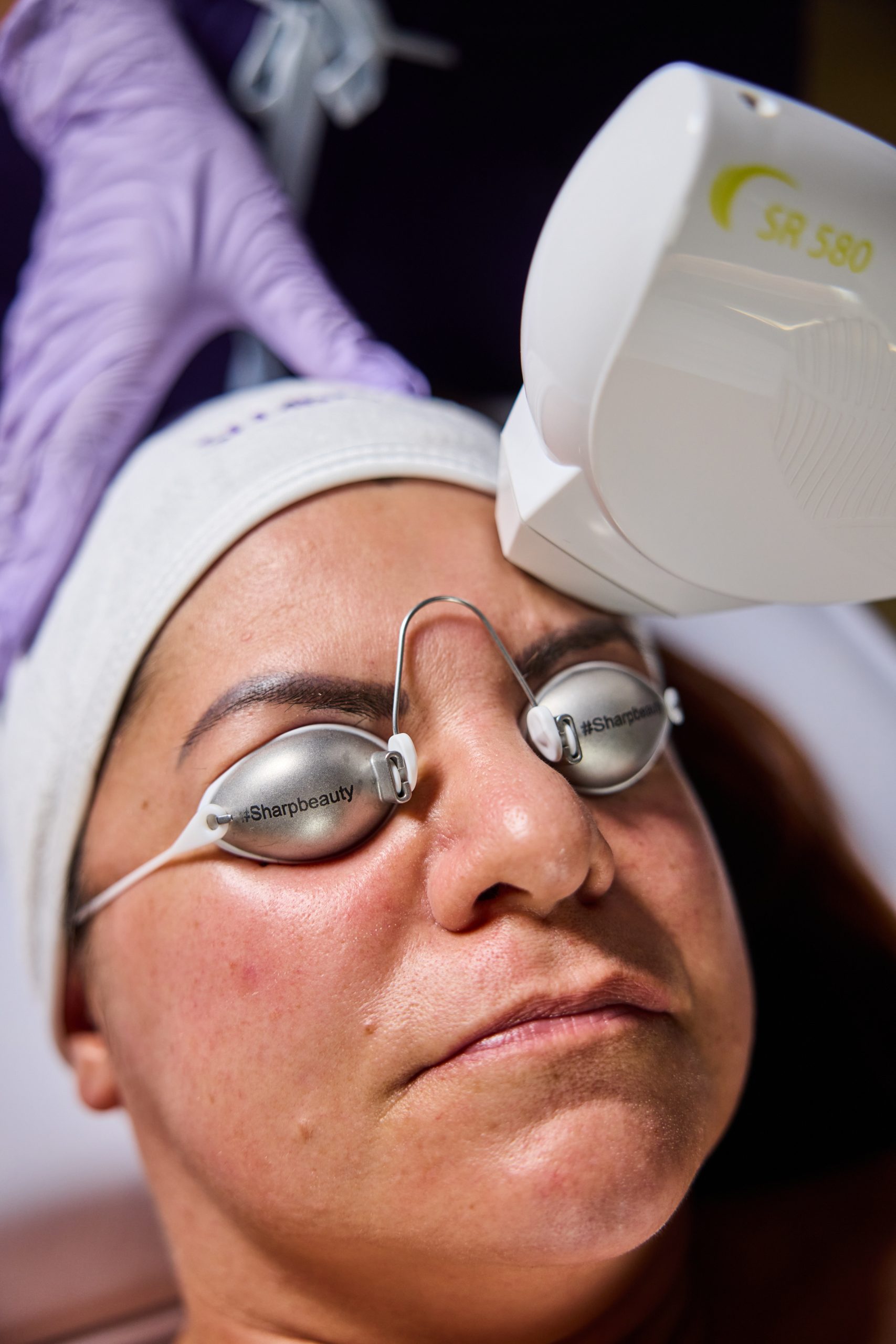 Skin rejuvenation clinic — Elite Laser Services Saskatoon